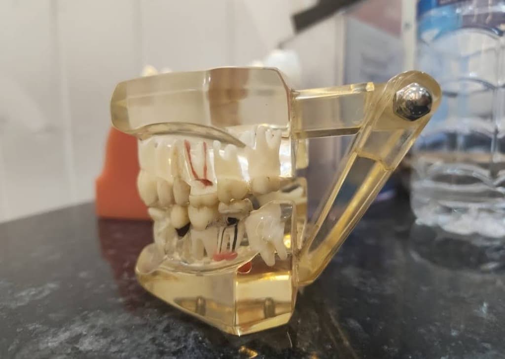 Educational Jaw & Root Canal Model